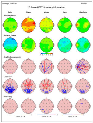 NeuroGuide