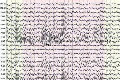 eeg brain